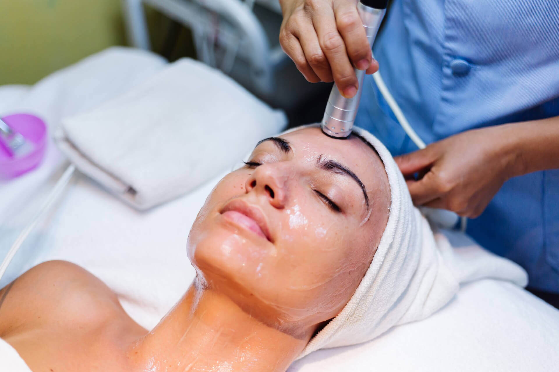 Chemical Peels for Acne Scars